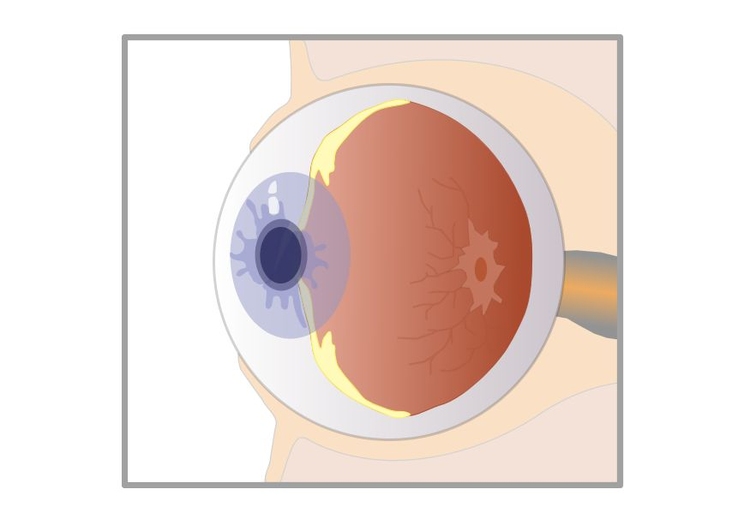 Afbeelding doorsnede oog