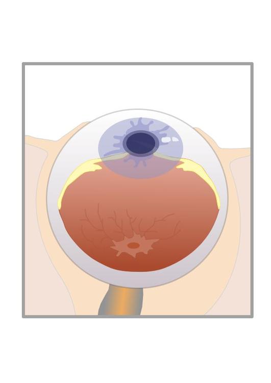 doorsnede oog