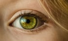 Foto's oog