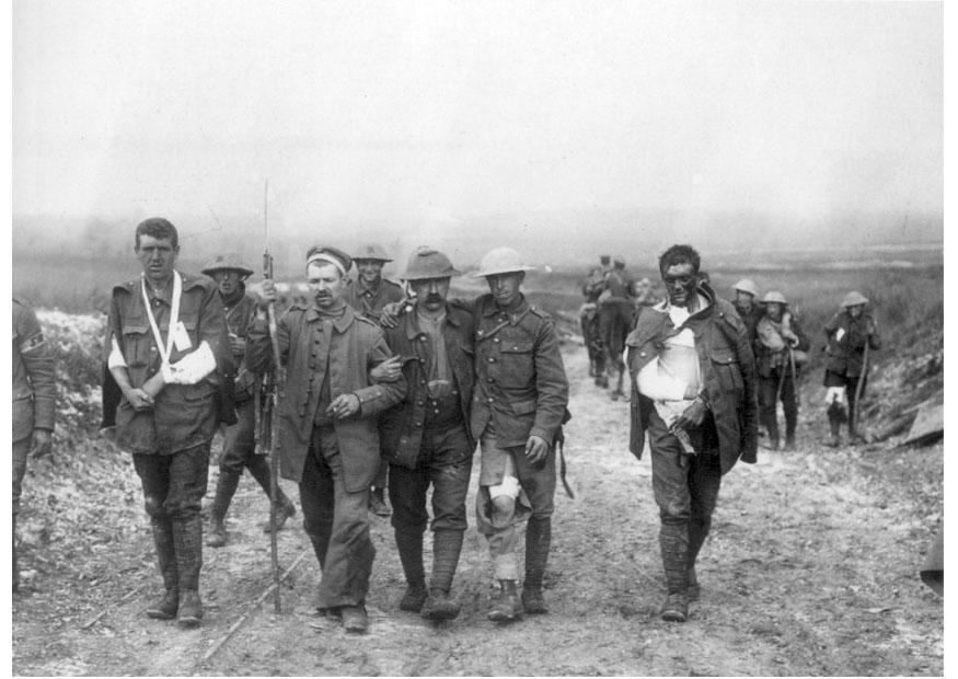 gewonde britse soldaten Foto gewonde britse soldaten
