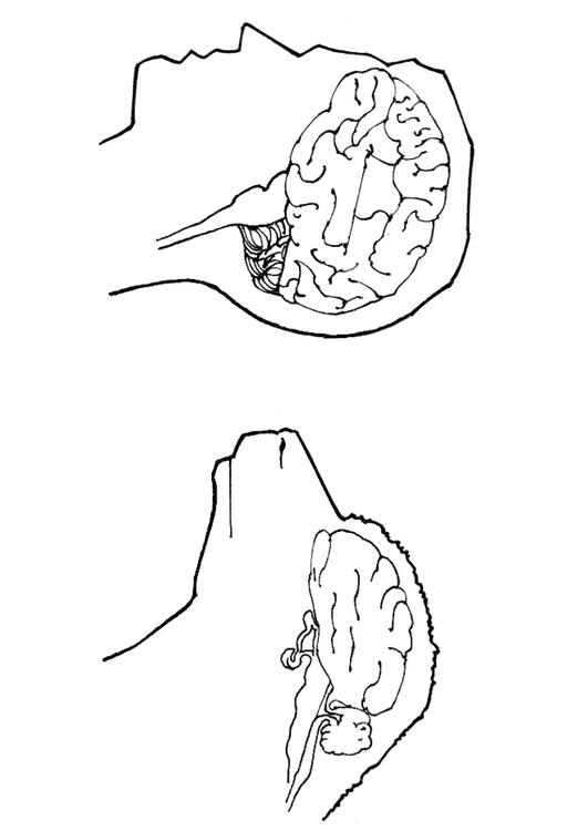 hersenen mens en schaap